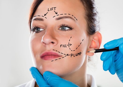Femme avec des lignes de perforation marquées sur le visage