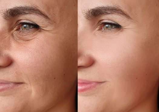 Chirurgie duvisage Istanbul