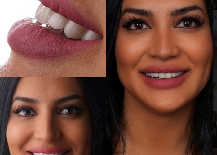 Facette en zirconium