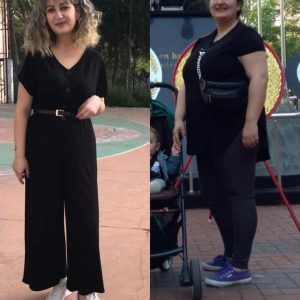 Patiente heureuse sleeve gastrique Janvier 2026