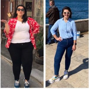 Sleeve gastrique patiente contente janvier 2026